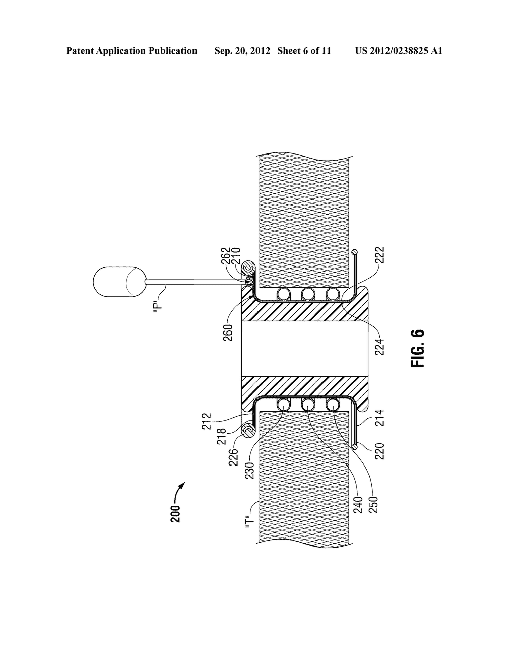 WOUND PROTECTOR INCLUDING BALLOON WITHIN INCISION - diagram, schematic, and image 07