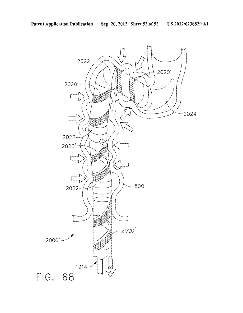 MODULAR TOOL HEADS FOR USE WITH CIRCULAR SURGICAL INSTRUMENTS - diagram, schematic, and image 53