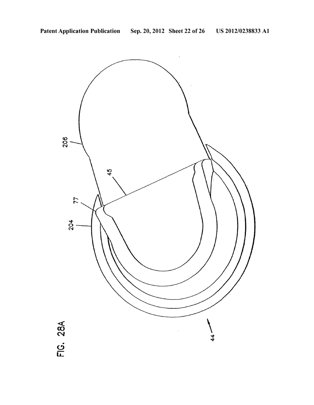 Analyte Monitoring Device and Methods of Use - diagram, schematic, and image 23