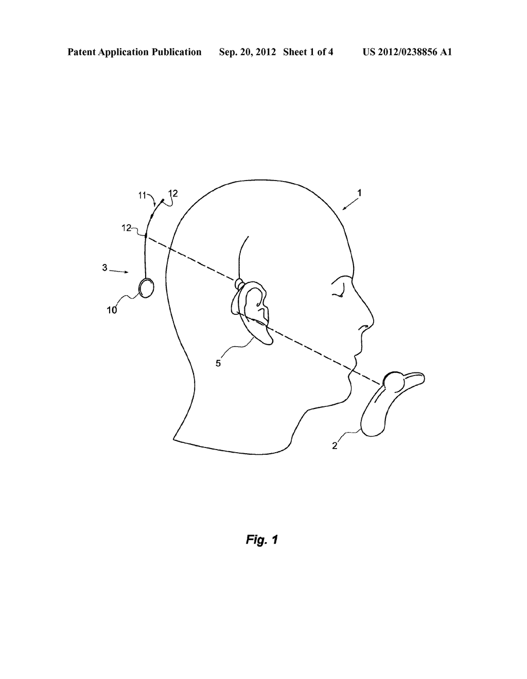 PORTABLE MONITORING DEVICE WITH HEARING AID AND EEG MONITOR - diagram, schematic, and image 02