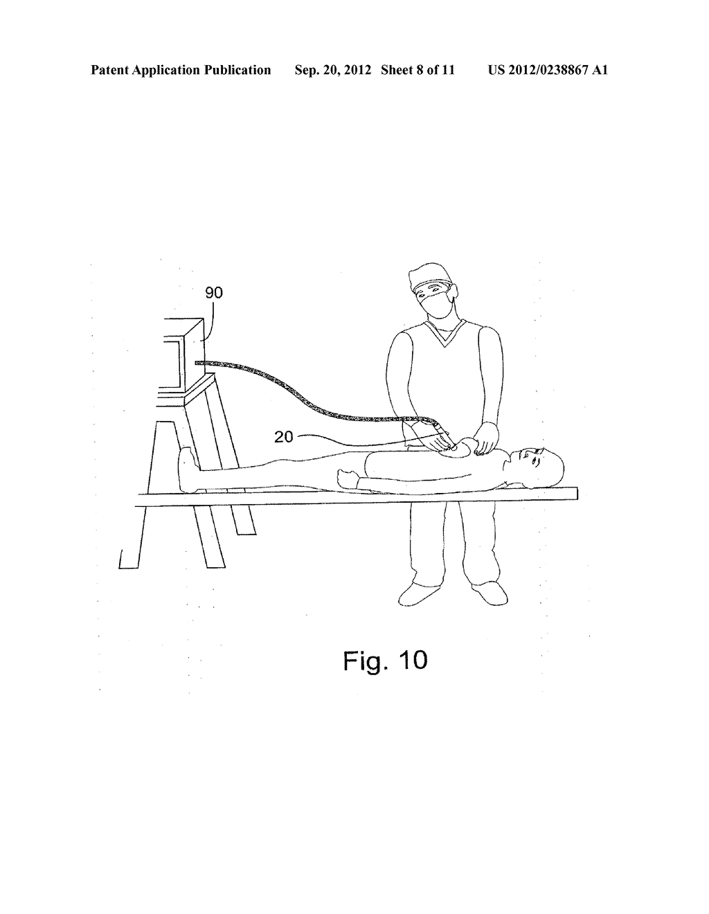 METHOD AND APPARATUS FOR EXAMINING TISSUE FOR PREDEFINED TARGET CELLS,     PARTICULARLY CANCEROUS CELLS, AND A PROBE USEFUL IN SUCH METHOD AND     APPARATUS - diagram, schematic, and image 09