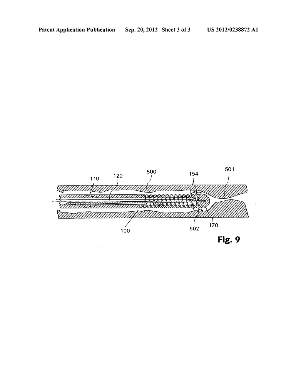 GUIDE WIRE - diagram, schematic, and image 04