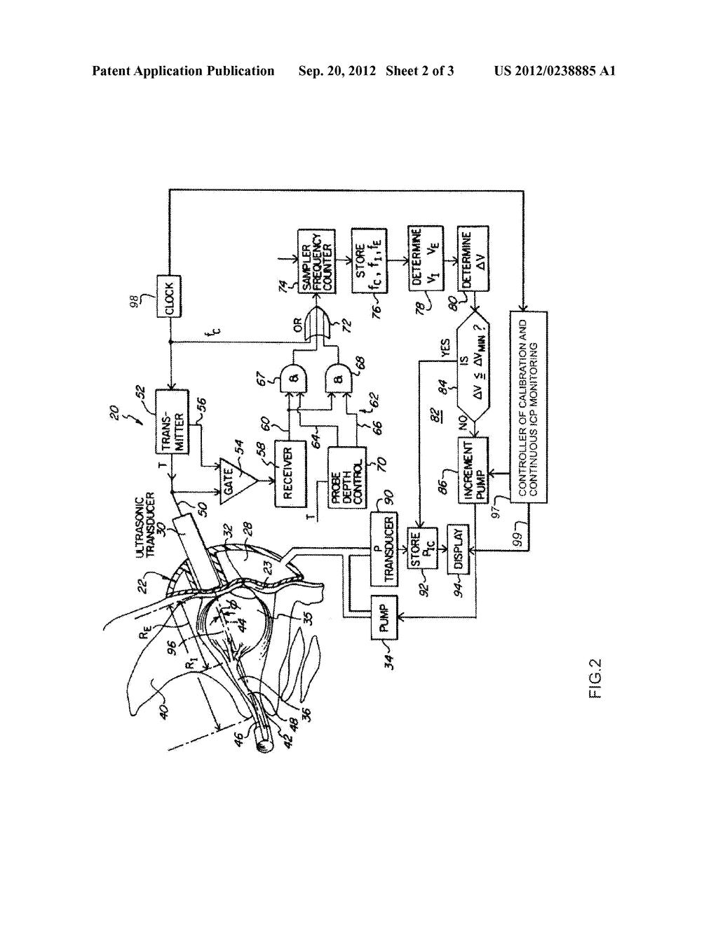 METHOD AND APPARATUS FOR CONTINUOUSLY MONITORING INTRACRANIAL PRESSURE - diagram, schematic, and image 03