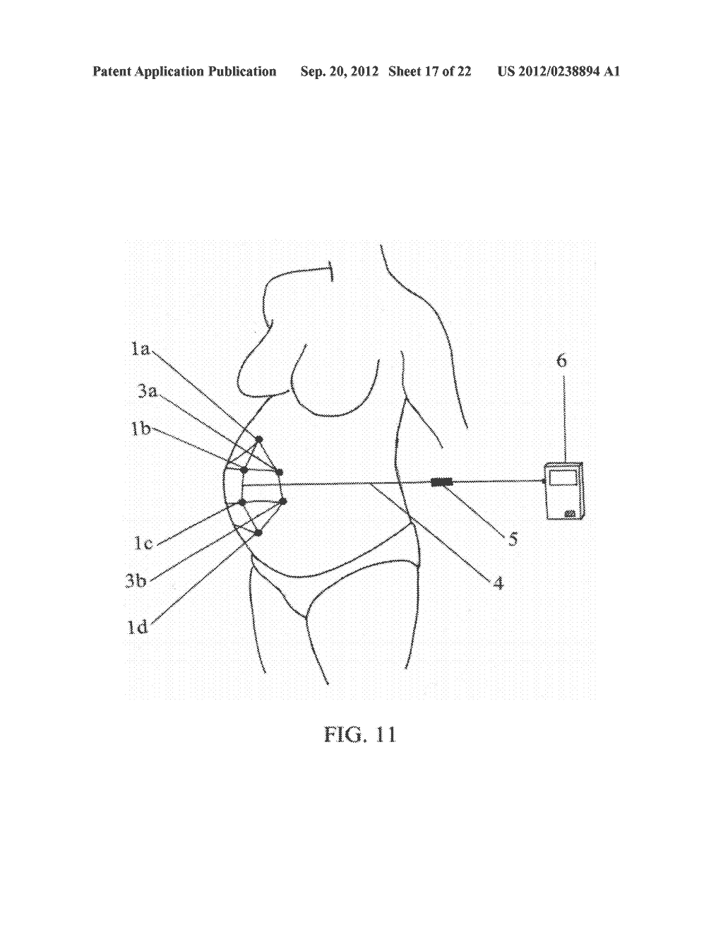 System and Method for Analyzing Progress of Labor and Preterm Labor - diagram, schematic, and image 18