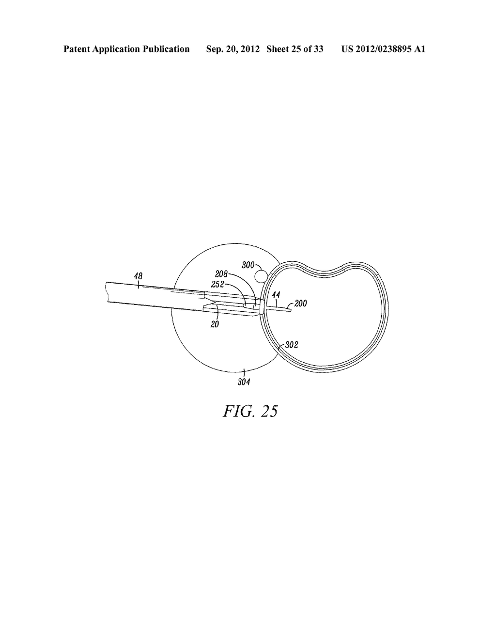 Surgical Access System and Related Methods - diagram, schematic, and image 26