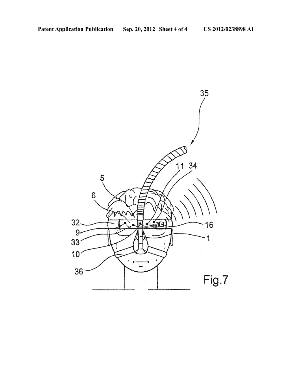DEVICE FOR DETECTING ELECTRICAL POTENTIALS OF THE FOREHEAD REGION OF A     PATIENT - diagram, schematic, and image 05