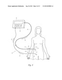 SYSTEMS AND METHODS FOR INTRA-OPERATIVE STIMULATION diagram and image