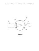 Ophthalmic Refractor and Method of Ophthalmic Refractor Signal Analysis diagram and image