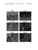 LABELED SKIN LESION BIOPSY PUNCH AND USES THEREOF diagram and image