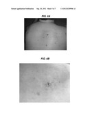 LABELED SKIN LESION BIOPSY PUNCH AND USES THEREOF diagram and image