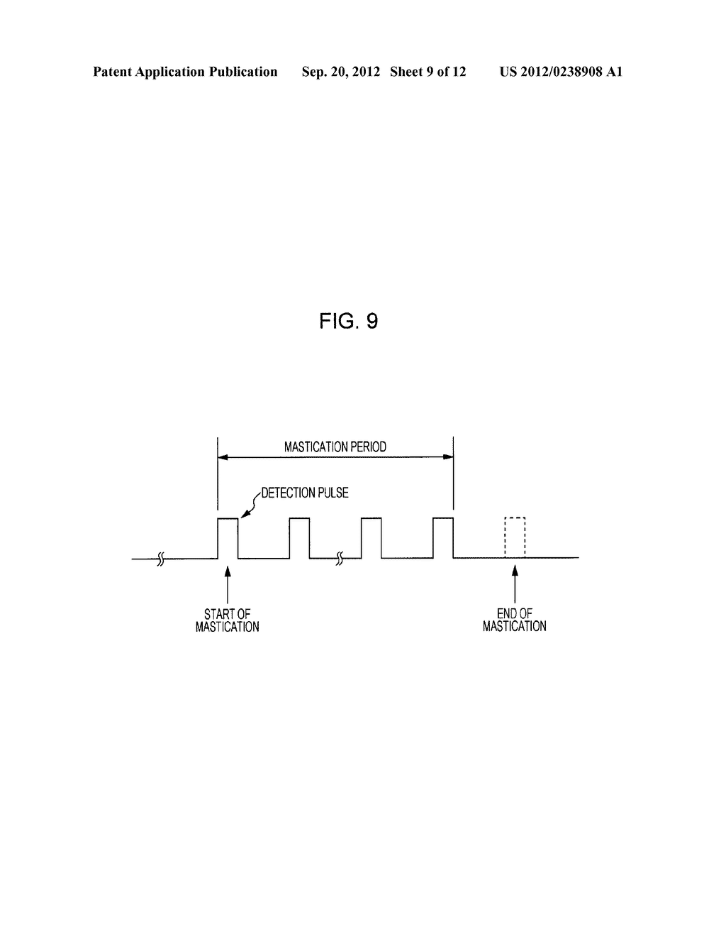 MASTICATION DETECTION DEVICE AND MASTICATION DETECTION METHOD - diagram, schematic, and image 10