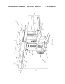 KNEE LIGAMENT BALANCER diagram and image