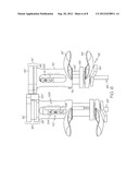 KNEE LIGAMENT BALANCER diagram and image