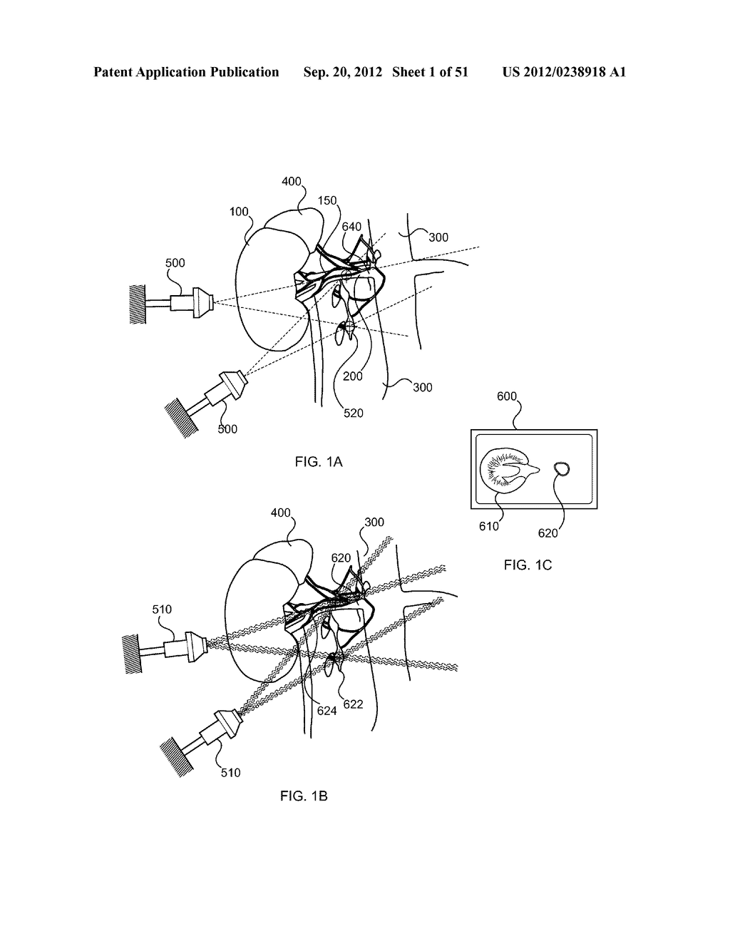 METHODS FOR DELIVERING ENERGY TO MODULATE NEURAL STRUCTURES - diagram, schematic, and image 02