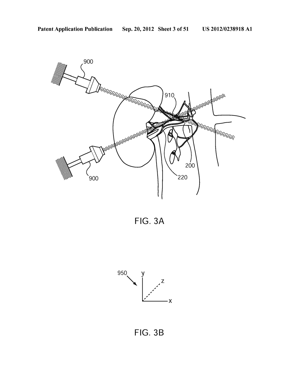 METHODS FOR DELIVERING ENERGY TO MODULATE NEURAL STRUCTURES - diagram, schematic, and image 04