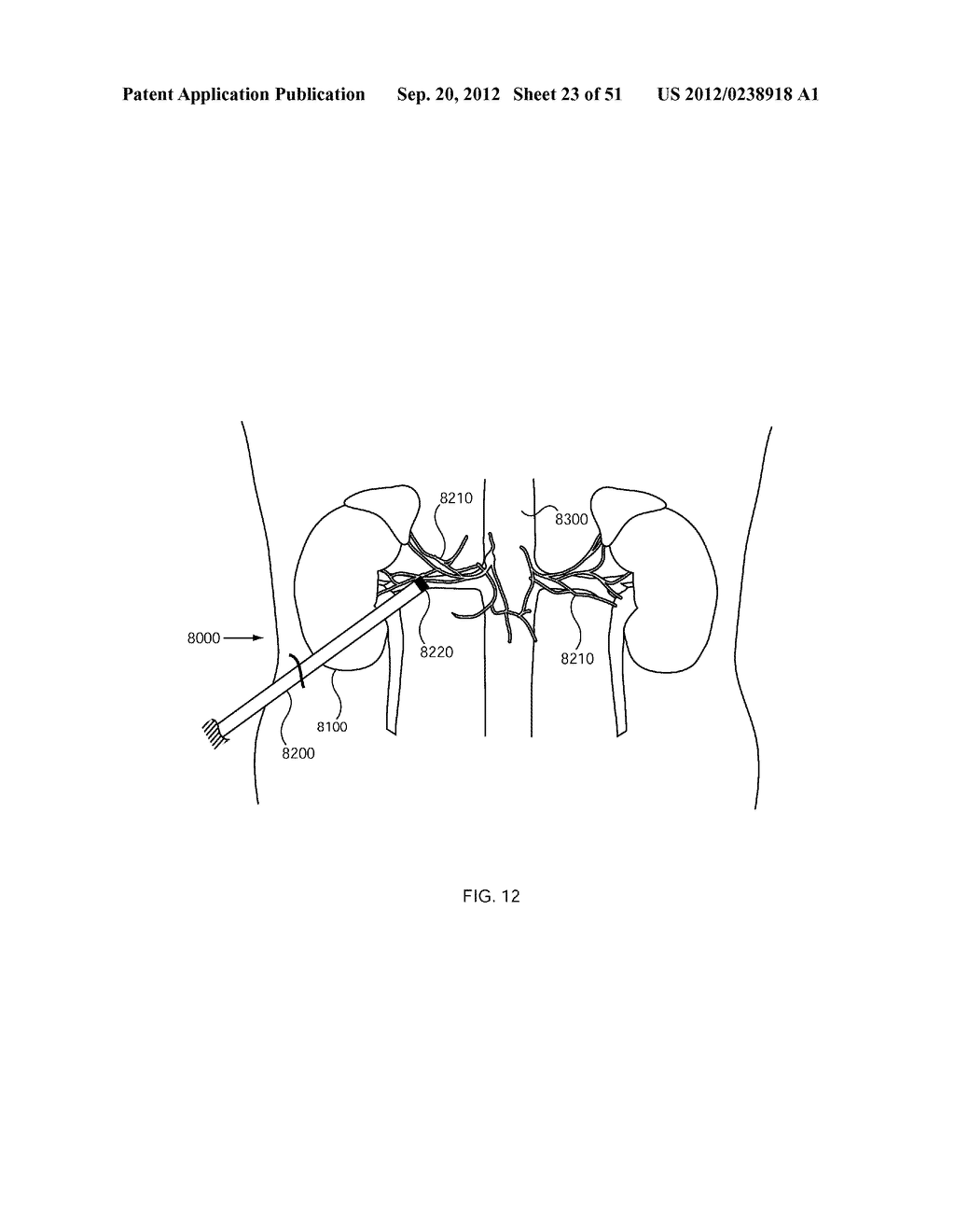 METHODS FOR DELIVERING ENERGY TO MODULATE NEURAL STRUCTURES - diagram, schematic, and image 24