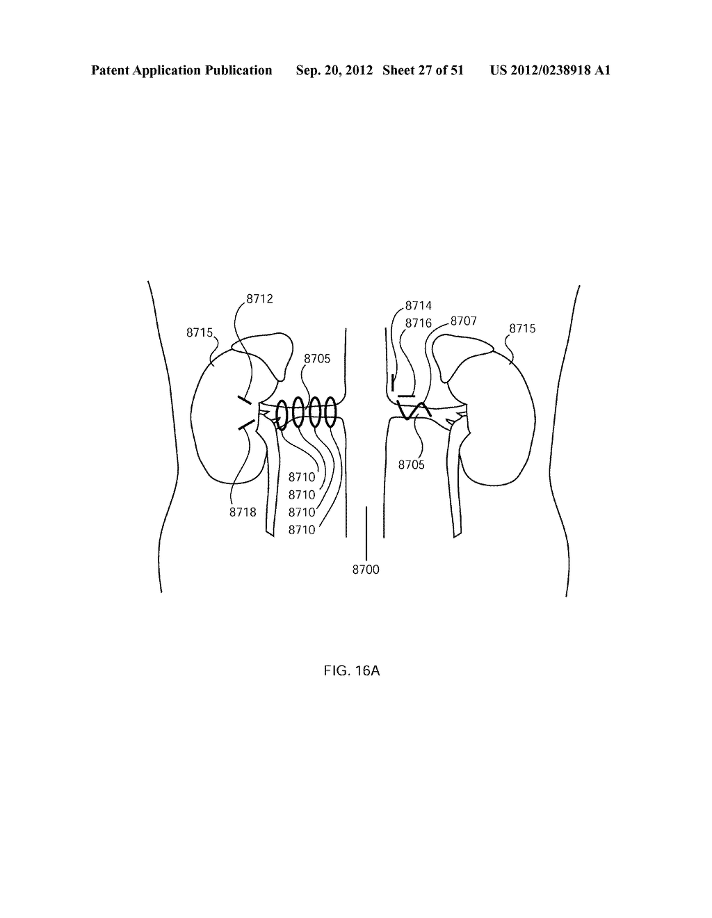 METHODS FOR DELIVERING ENERGY TO MODULATE NEURAL STRUCTURES - diagram, schematic, and image 28