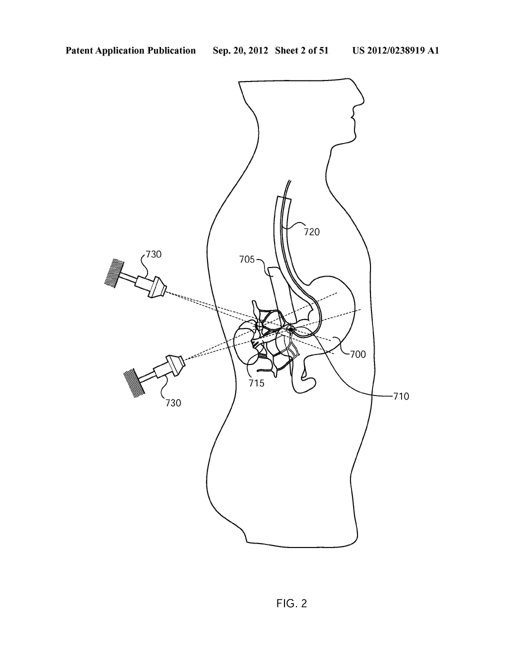 NERVE TREATMENT SYSTEM - diagram, schematic, and image 03