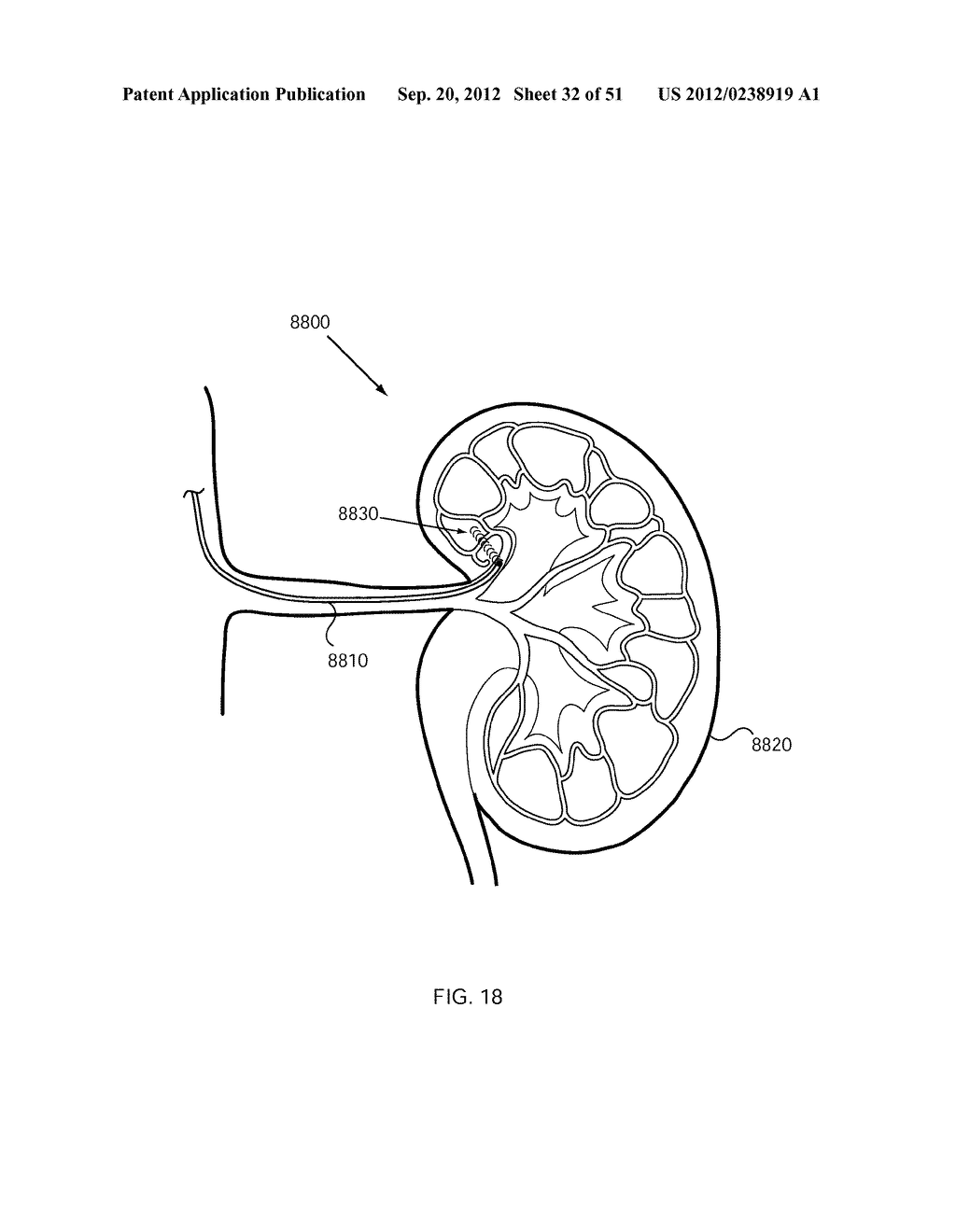 NERVE TREATMENT SYSTEM - diagram, schematic, and image 33