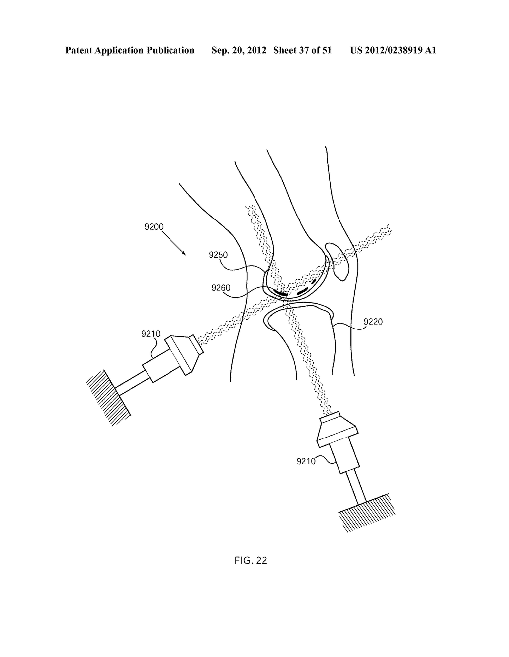 NERVE TREATMENT SYSTEM - diagram, schematic, and image 38