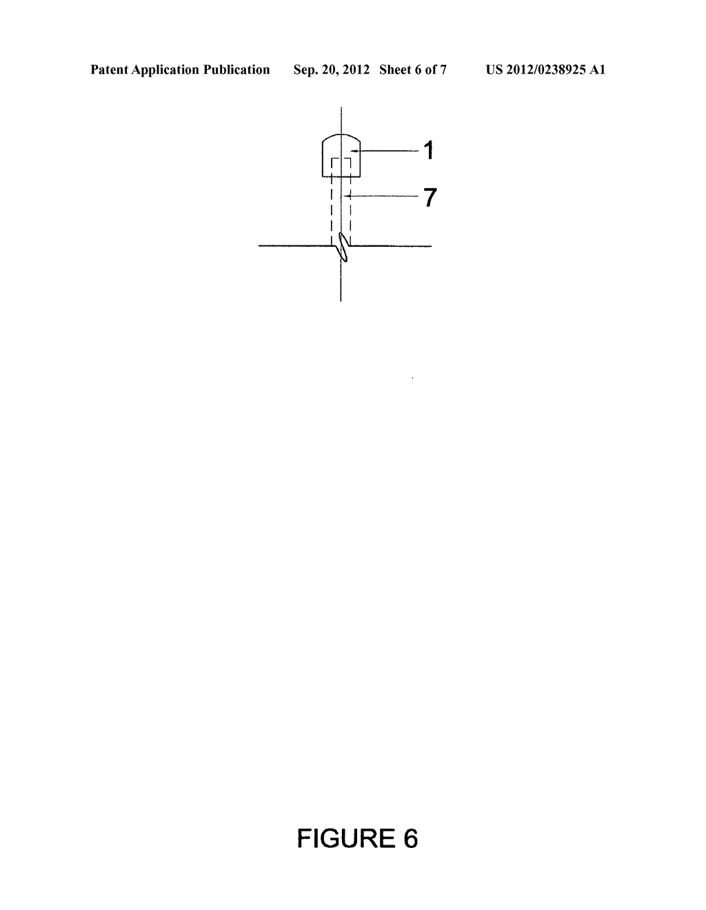 Interchangeable pressure therapy tool - diagram, schematic, and image 07