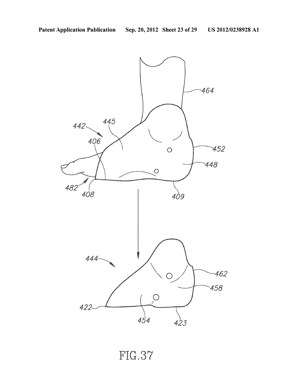 FOOT ORTHOSIS SUPPORT DEVICE METHOD AND APPARATUS - diagram, schematic, and image 24