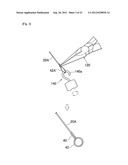 NAIL CORRECTIVE BRACE diagram and image