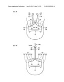 NAIL CORRECTIVE BRACE diagram and image