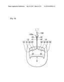 NAIL CORRECTIVE BRACE diagram and image