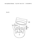 NAIL CORRECTIVE BRACE diagram and image