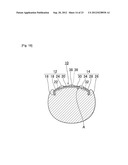 NAIL CORRECTIVE BRACE diagram and image