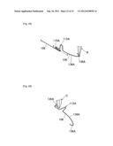 NAIL CORRECTIVE BRACE diagram and image