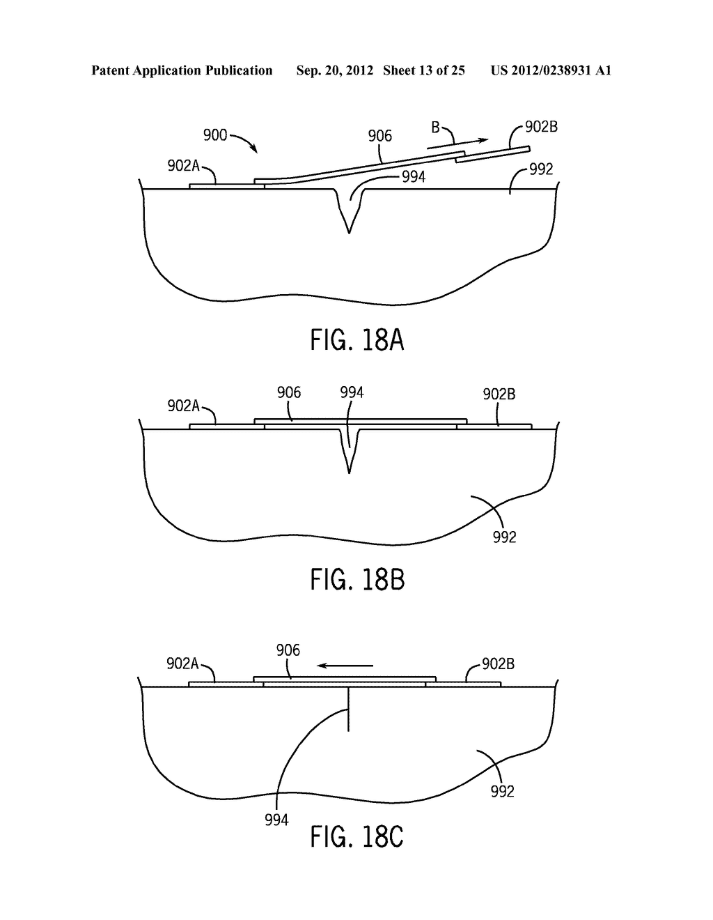 Shape and Pressure Adjustable Dressing - diagram, schematic, and image 14