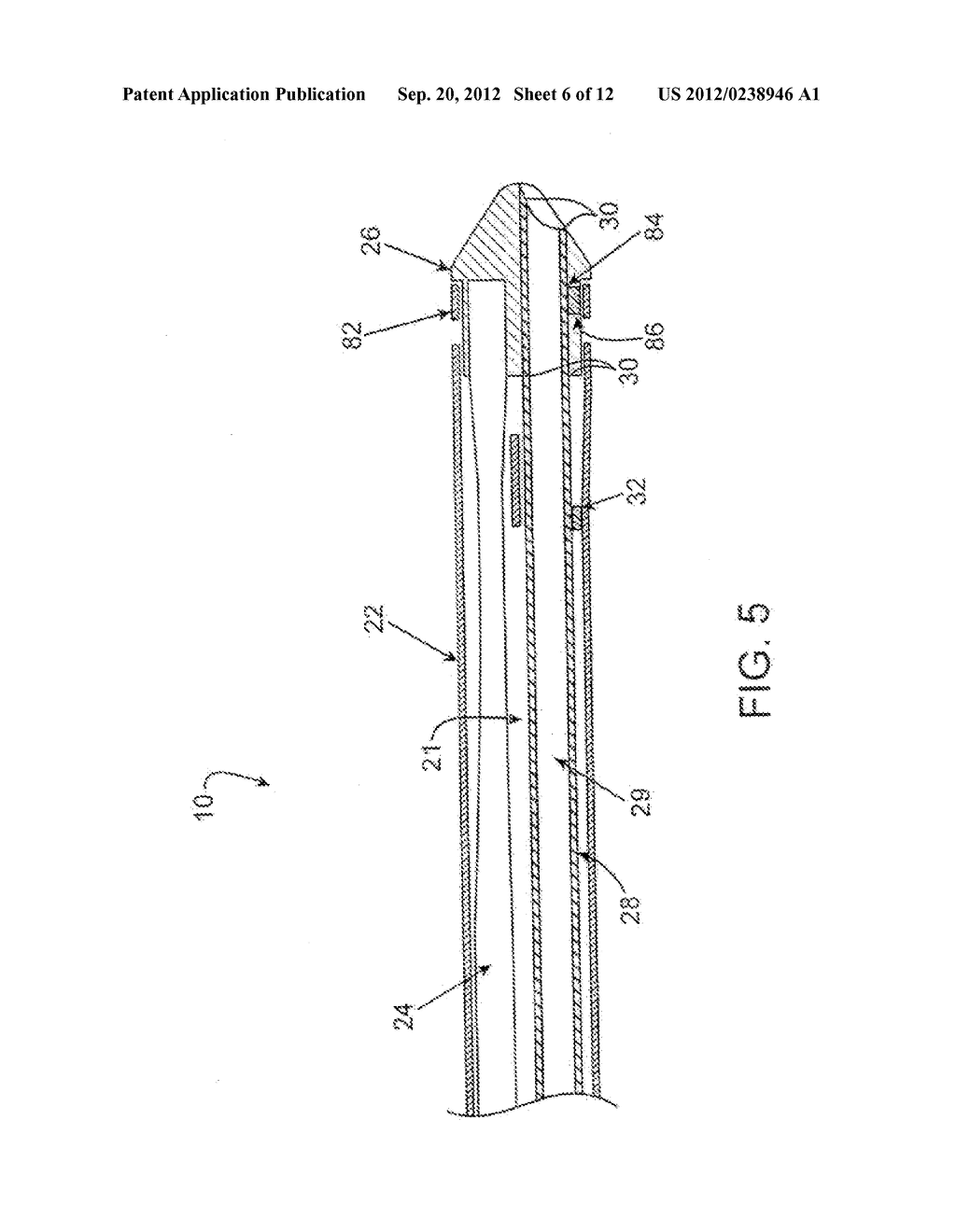 ULTRASOUND CATHETER AND METHODS FOR MAKING AND USING SAME - diagram, schematic, and image 07