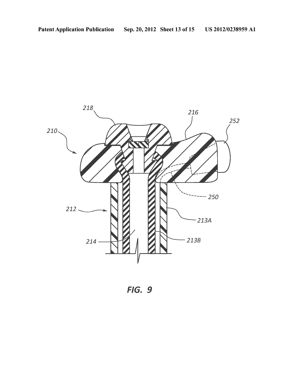 Biased Internal Bolster for a Medical Device - diagram, schematic, and image 14