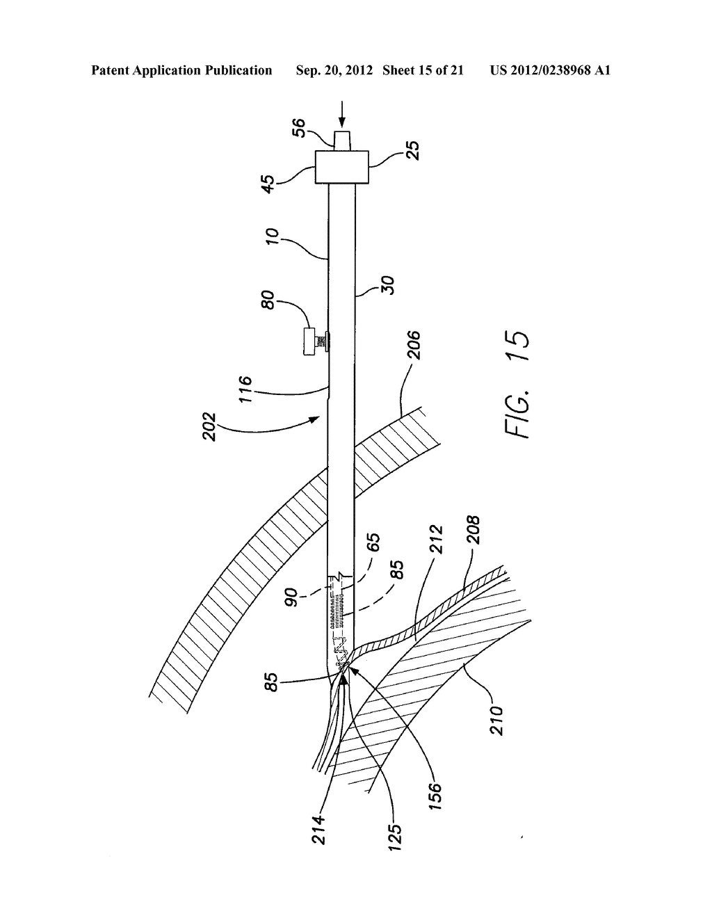 APPARATUS AND METHOD FOR ACCESSING AN INTRAPERICARDIAL SPACE - diagram, schematic, and image 16