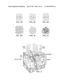 Radiation-Based Dermatological Devices and Methods diagram and image