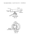 Radiation-Based Dermatological Devices and Methods diagram and image