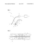 Apparatus for endobronchial ablation of a tumor diagram and image