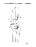 GROWTH CONTROL DEVICE diagram and image