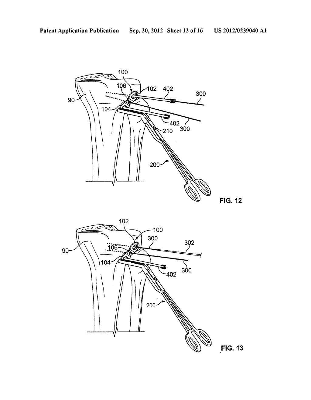 GROWTH CONTROL DEVICE - diagram, schematic, and image 13