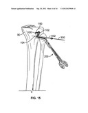 GROWTH CONTROL DEVICE diagram and image