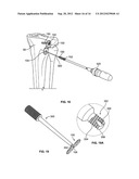 GROWTH CONTROL DEVICE diagram and image