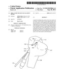 Drill guide for cruciate ligament repair diagram and image