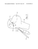 Drill guide for cruciate ligament repair diagram and image