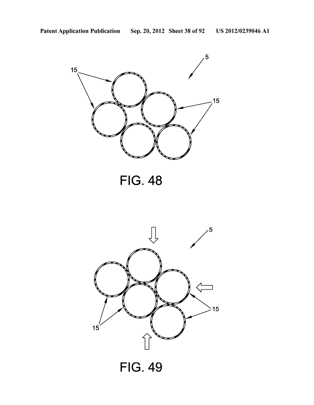 METHOD AND APPARATUS FOR DISTRACTING A JOINT - diagram, schematic, and image 39