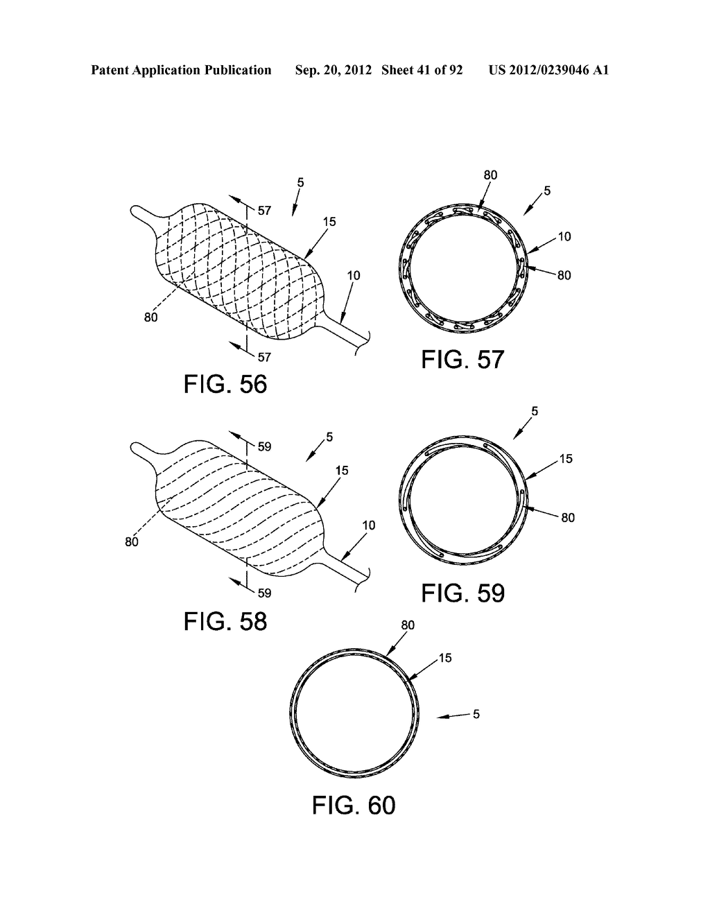 METHOD AND APPARATUS FOR DISTRACTING A JOINT - diagram, schematic, and image 42