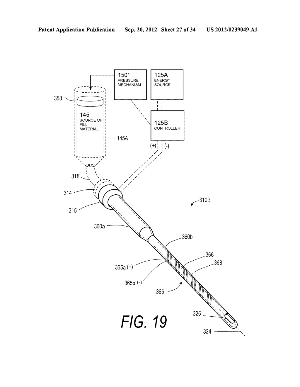 SYSTEMS FOR DELIVERING BONE FILL MATERIAL - diagram, schematic, and image 28