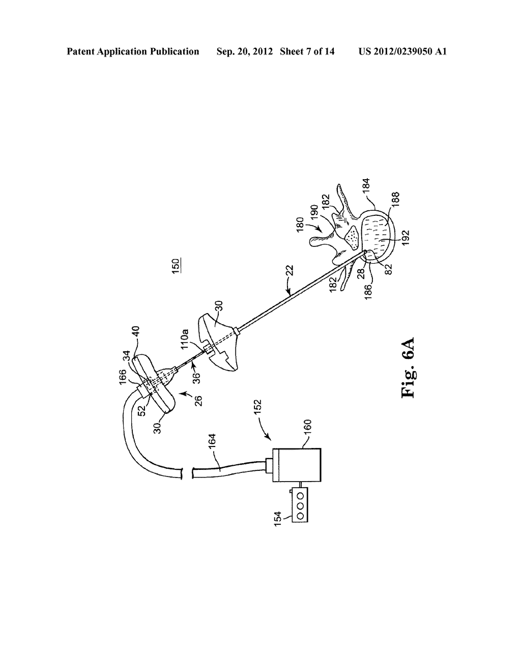 MULTISTATE-CURVATURE DEVICE AND METHOD FOR DELIVERING A CURABLE MATERIAL     INTO BONE - diagram, schematic, and image 08