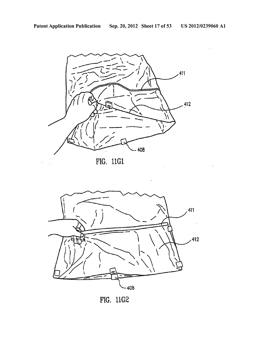 Disposable Sterile Surgical Adaptor - diagram, schematic, and image 18